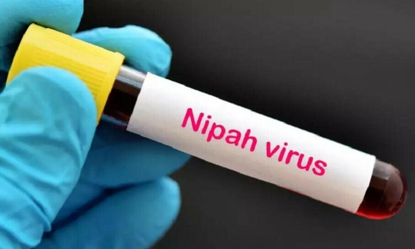Bộ Y tế thông tin về dịch bệnh do virus Nipah gây ra