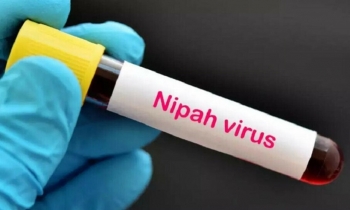 Bộ Y tế thông tin về dịch bệnh do virus Nipah gây ra