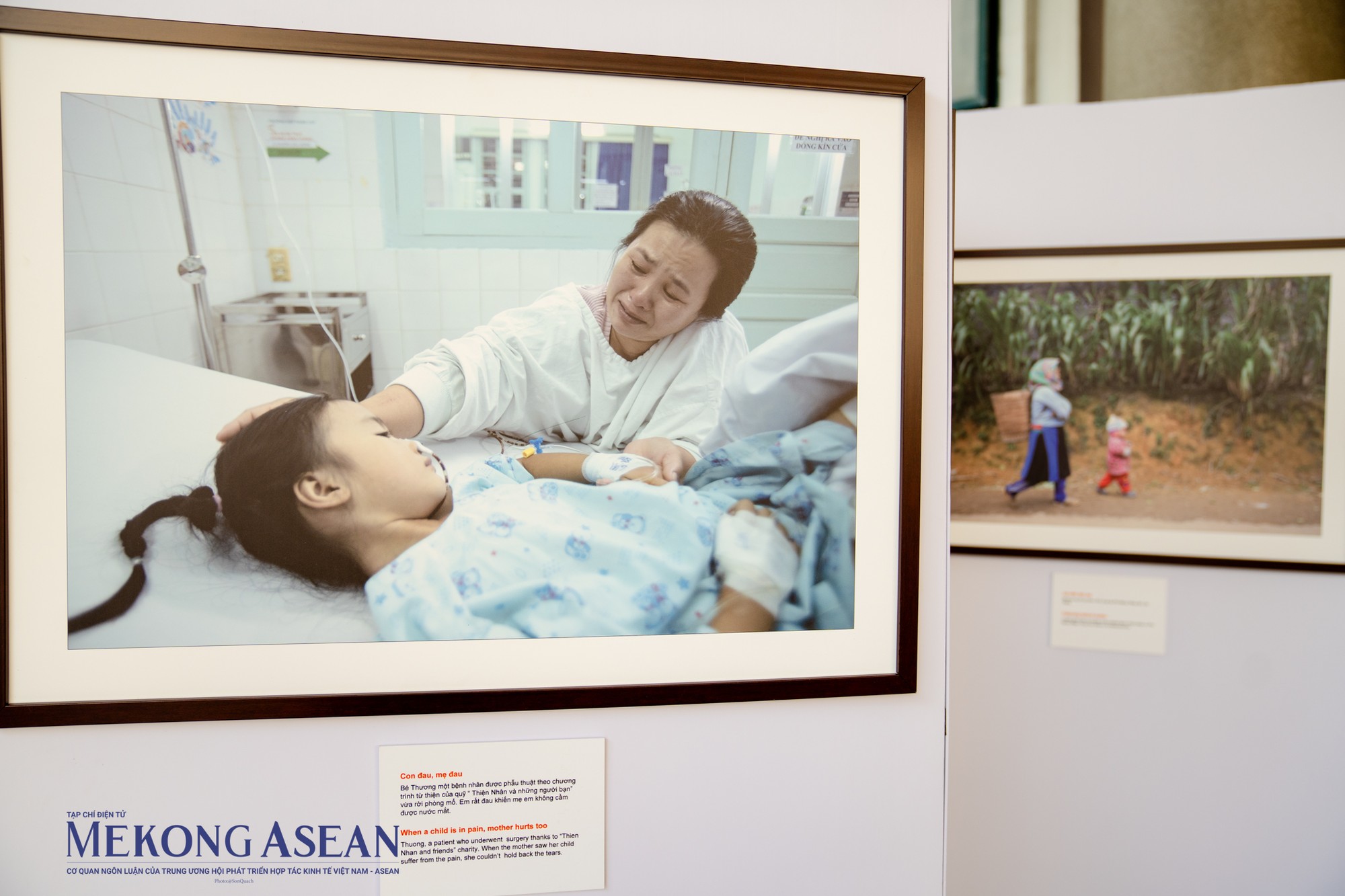 T&aacute;c phẩm &amp;amp;amp;quot;Con đau, mẹ đau&amp;amp;amp;quot; được chụp khi b&eacute; Thương, một bệnh nh&acirc;n được phẫu thuật theo chương tr&igrave;nh từ thiện, vừa rời ph&ograve;ng mổ. Em rất đau, c&ograve;n người mẹ kh&ocirc;ng cầm được nước mắt trong khoảnh khắc nh&igrave;n con, sau ca mổ k&eacute;o d&agrave;i hơn 4 tiếng đồng hồ.