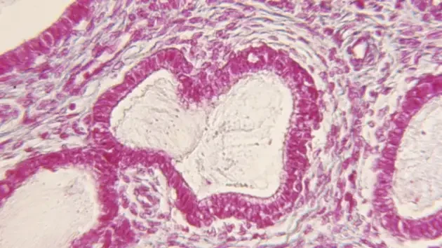 Nghi&ecirc;n cứu của Women&rsquo;s Health Access Matters cho thấy khoản đầu tư 300 triệu USD v&agrave;o việc cải thiện sức khỏe phụ nữ c&oacute; thể tạo ra khoảng 13 tỷ USD cho nền kinh tế thế giới. Ảnh: Getty Images