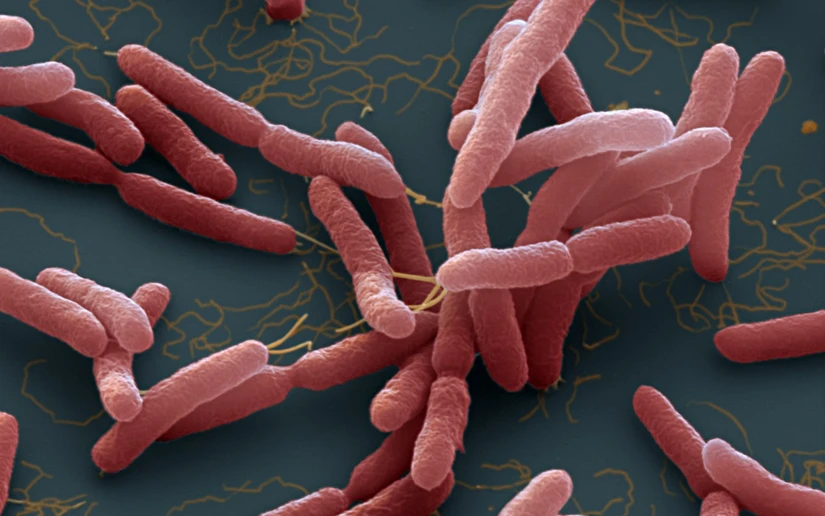 Vi khuẩn Burkholderia pseudomallei g&acirc;y n&ecirc;n bệnh Whitmore. Ảnh: NPR